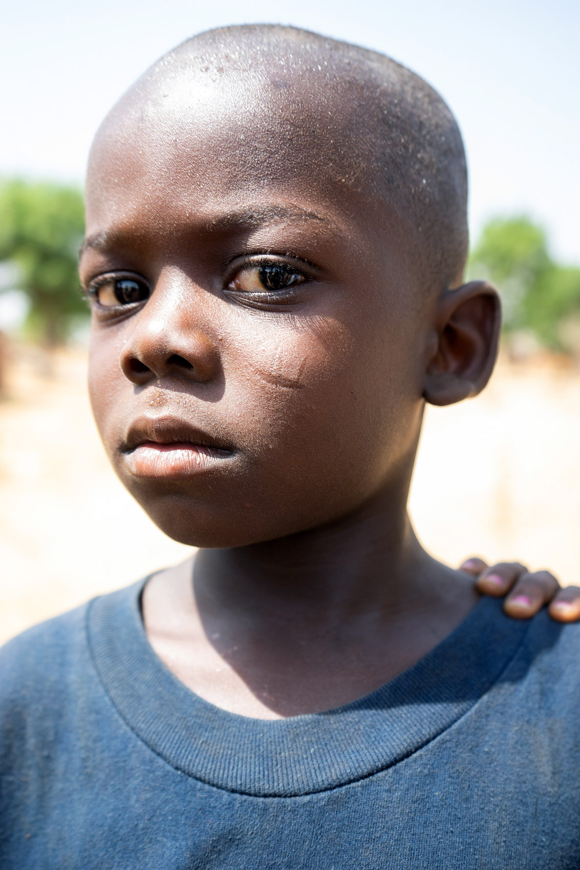 Junge mit Narbenverzierung in Ghana